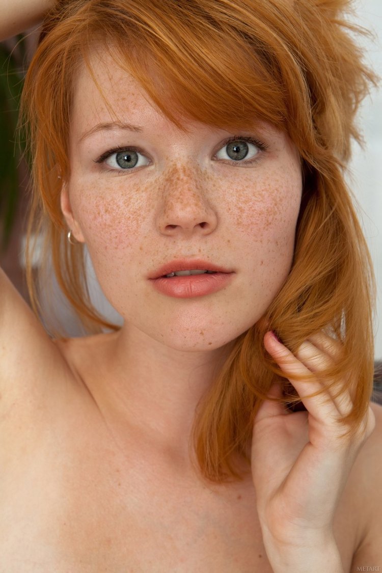 Red freckles